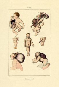 フリーク、1833-39 作： French School